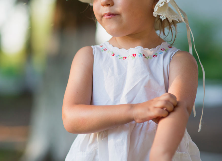 Young girl itching bug bite on arm.