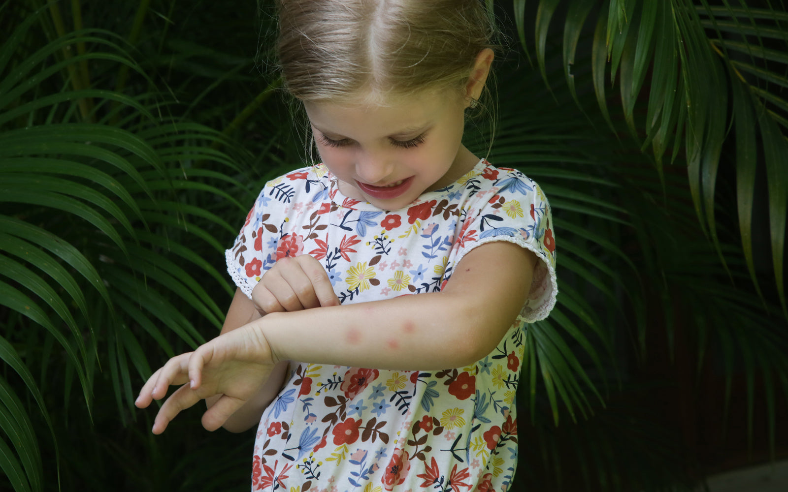 When Bugs Bite Back: How to Treat Bites & Stings